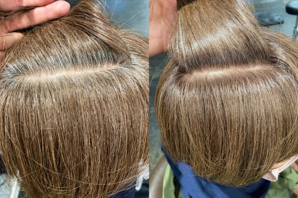 白髪改善 ビフォーアフター