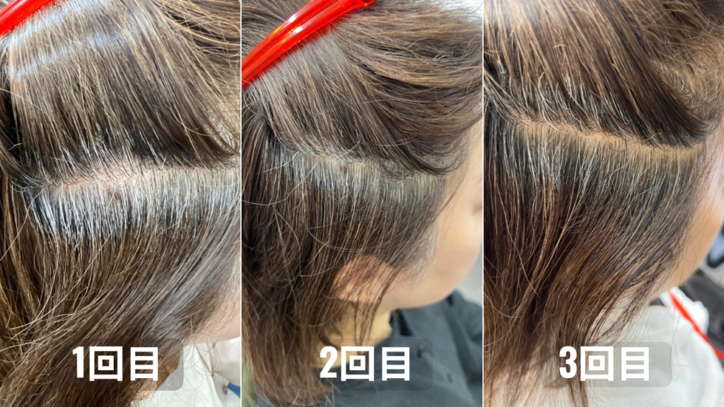 白髪改善 1回目→2回目→3回目